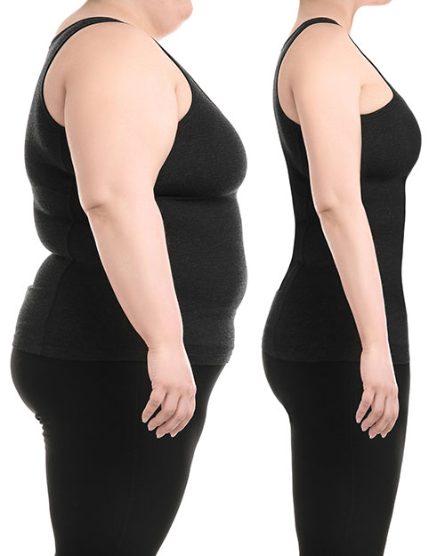 liposuction-services2