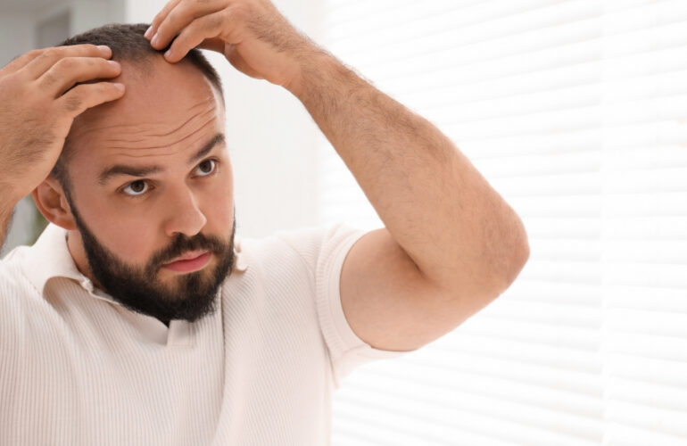 تكلفة زراعة الشعر في مقدمة الرأس