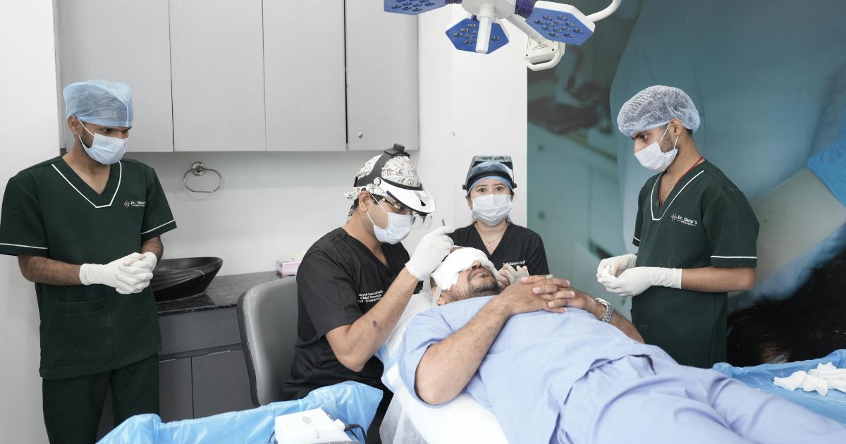 الأسئلة الشائعة حول عملية زراعة الشعر
