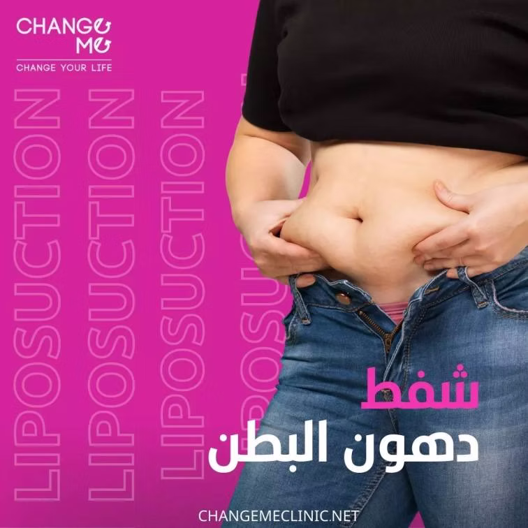 أنواع عمليات شفط الدهون