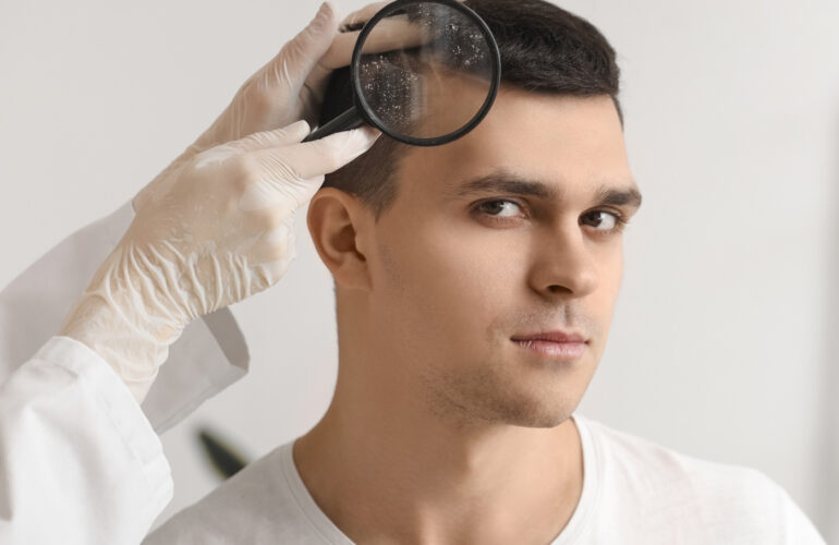 زراعة الشعر في مصر