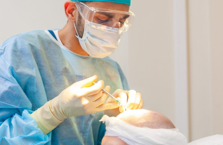 أرخص مراكز زراعة الشعر في مصر