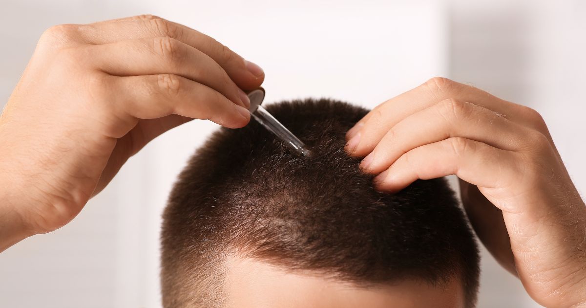 أنواع عمليات زراعة الشعر