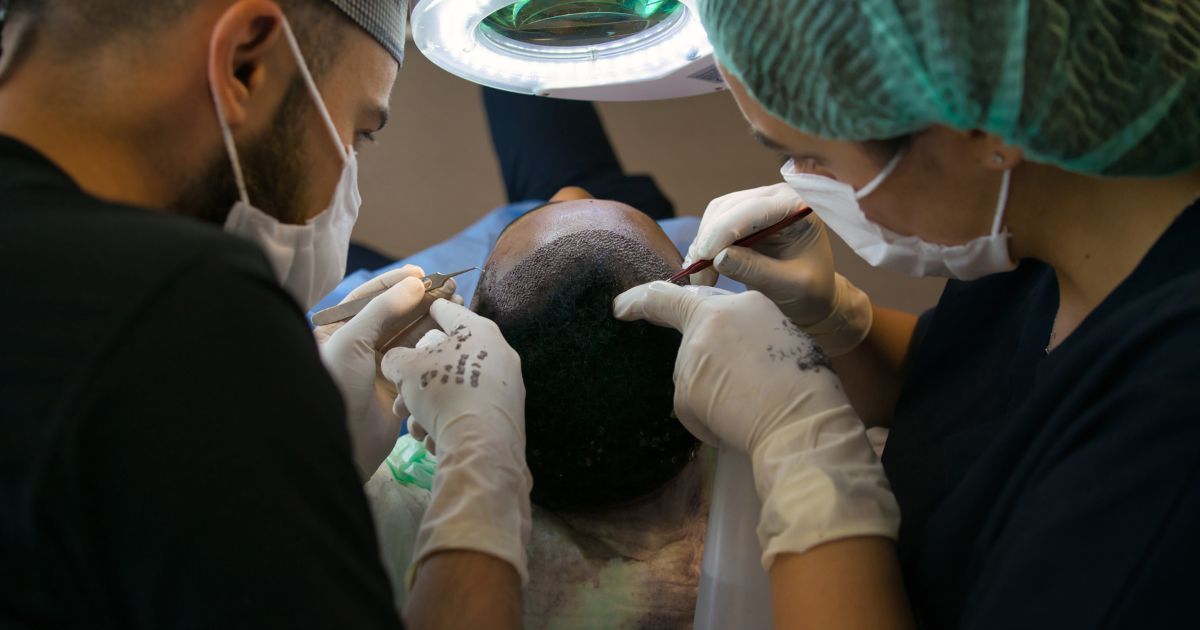 أفضل مركز زراعة شعر في مصر
